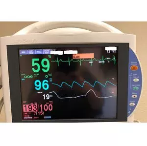 Study Reveals Real-Time Monitoring Sharply Reduces Postoperative Desaturation Events Study Reveals Real-Time Monitoring Sharply Reduces Postoperative Desaturation Events