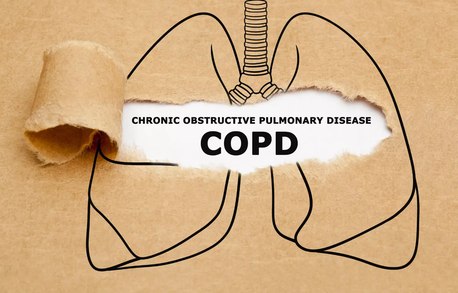 COPD causes premature aging of the immune system, study suggests