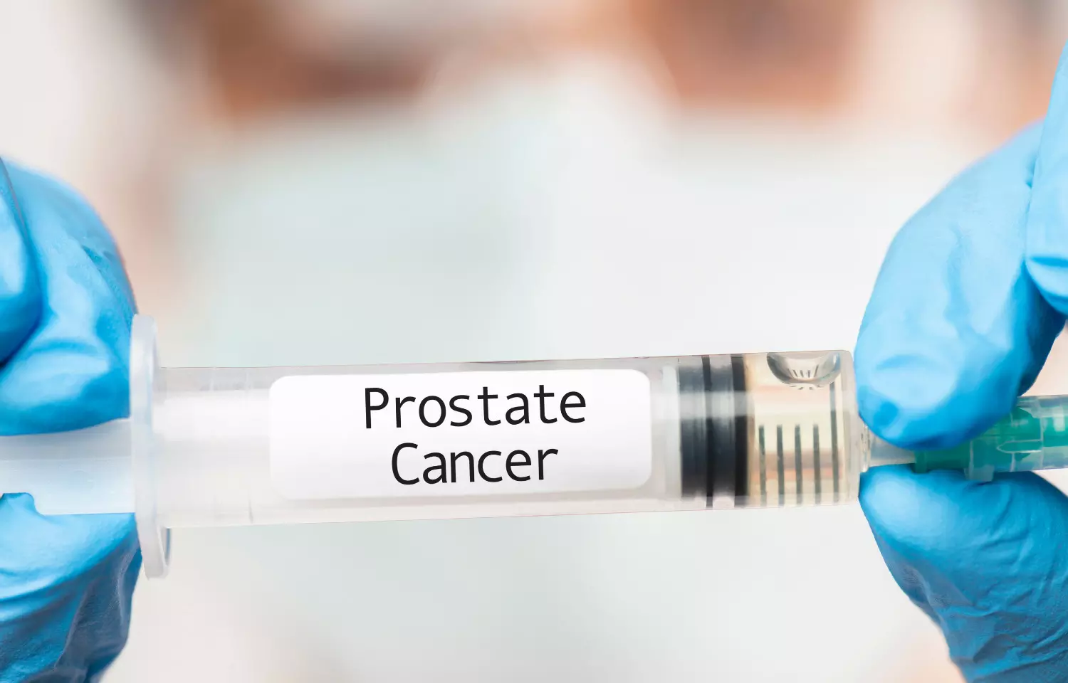 PSA prostate cancer screening found more beneficial than previous estimates, especially for blacks