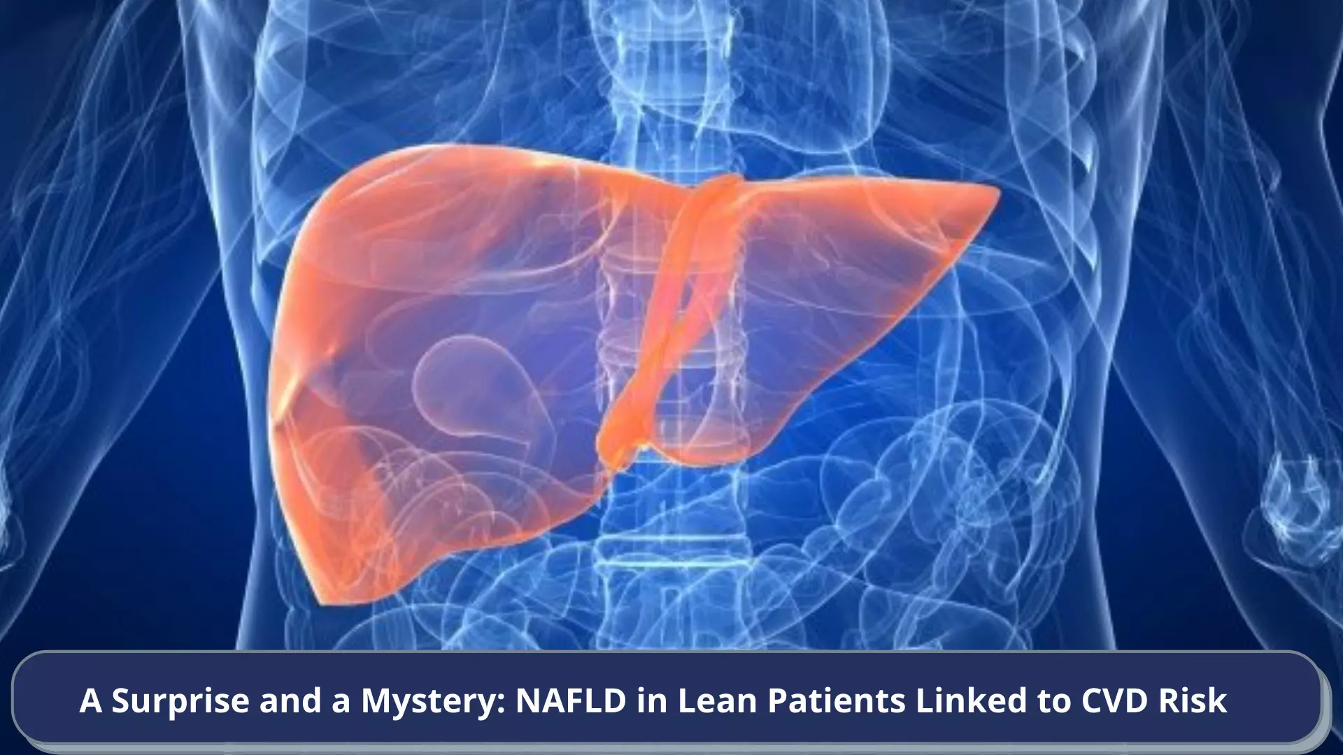 A Surprise and a Mystery: NAFLD in Lean Patients Linked to CVD Risk