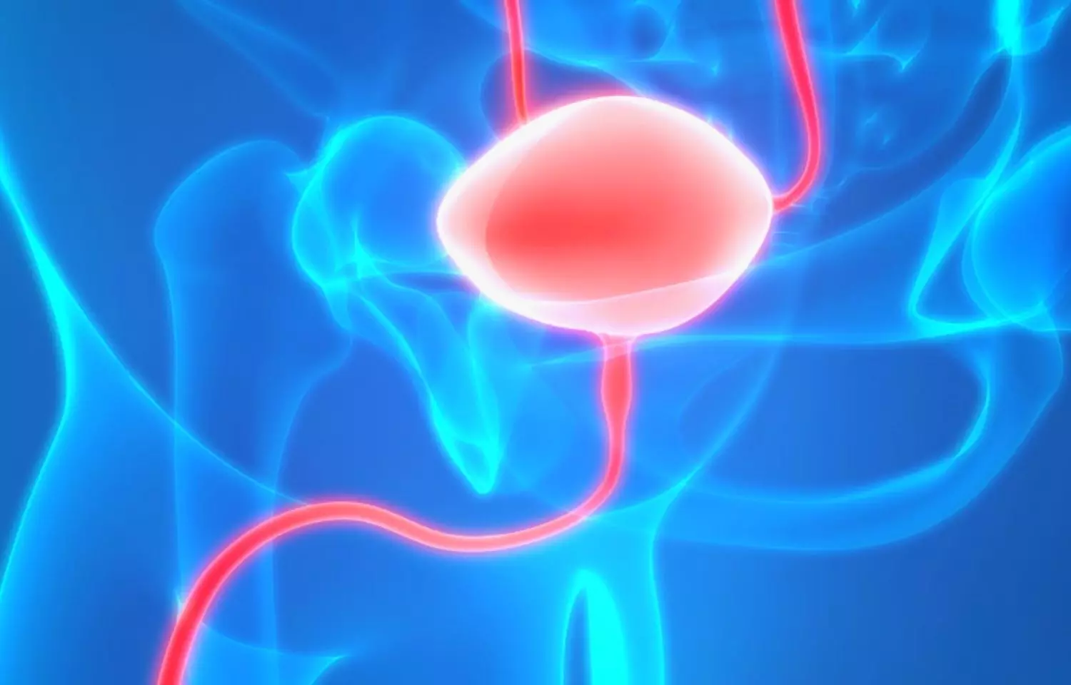AUA guidelines on diagnosis and treatment of interstitial cystitis/bladder pain syndrome