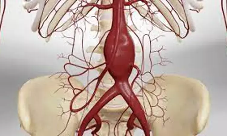 Endovascular aneurysm repair tied with long-term rupture and intervention: JAMA