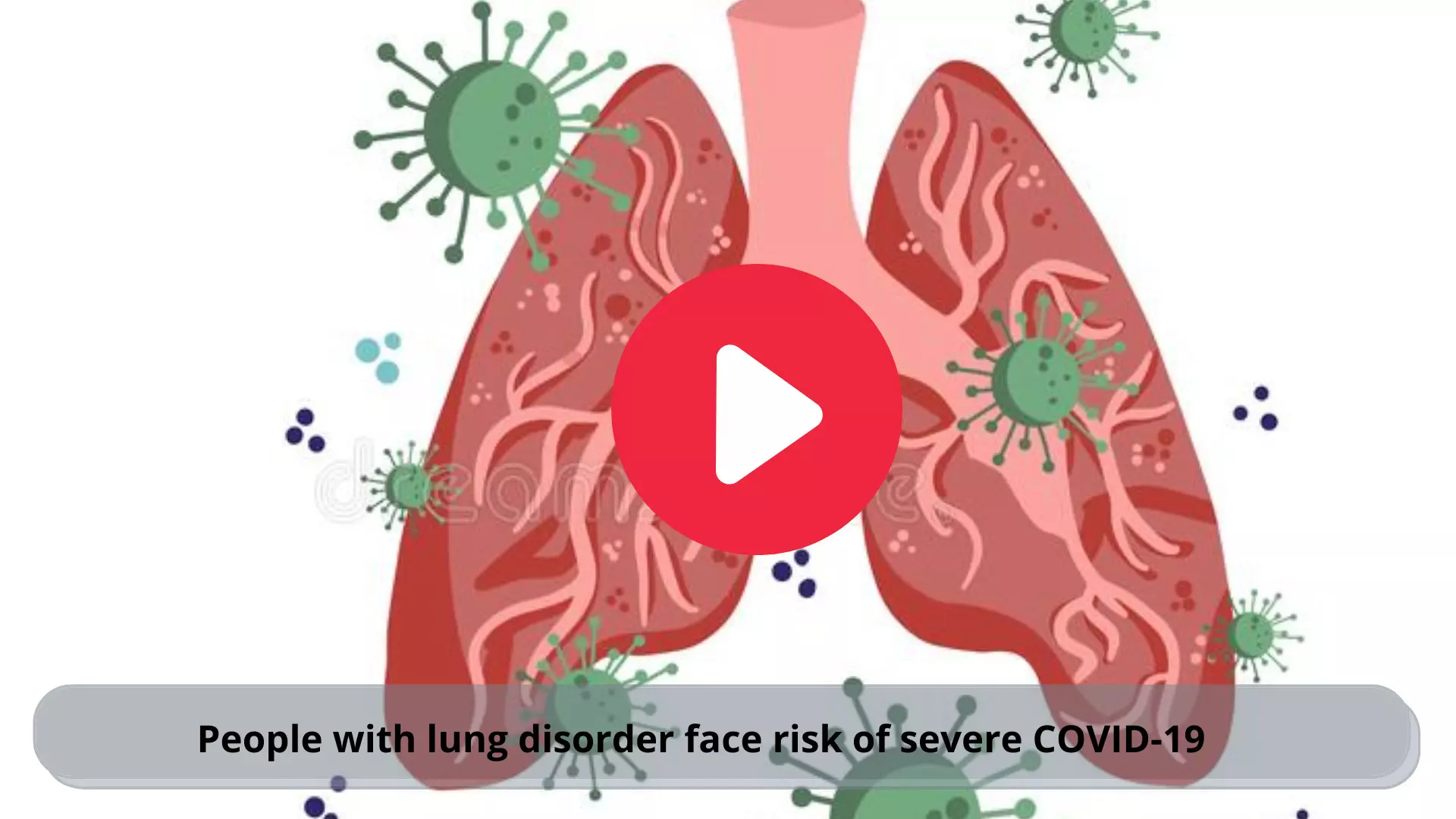People with lung disorder face risk of severe COVID-19