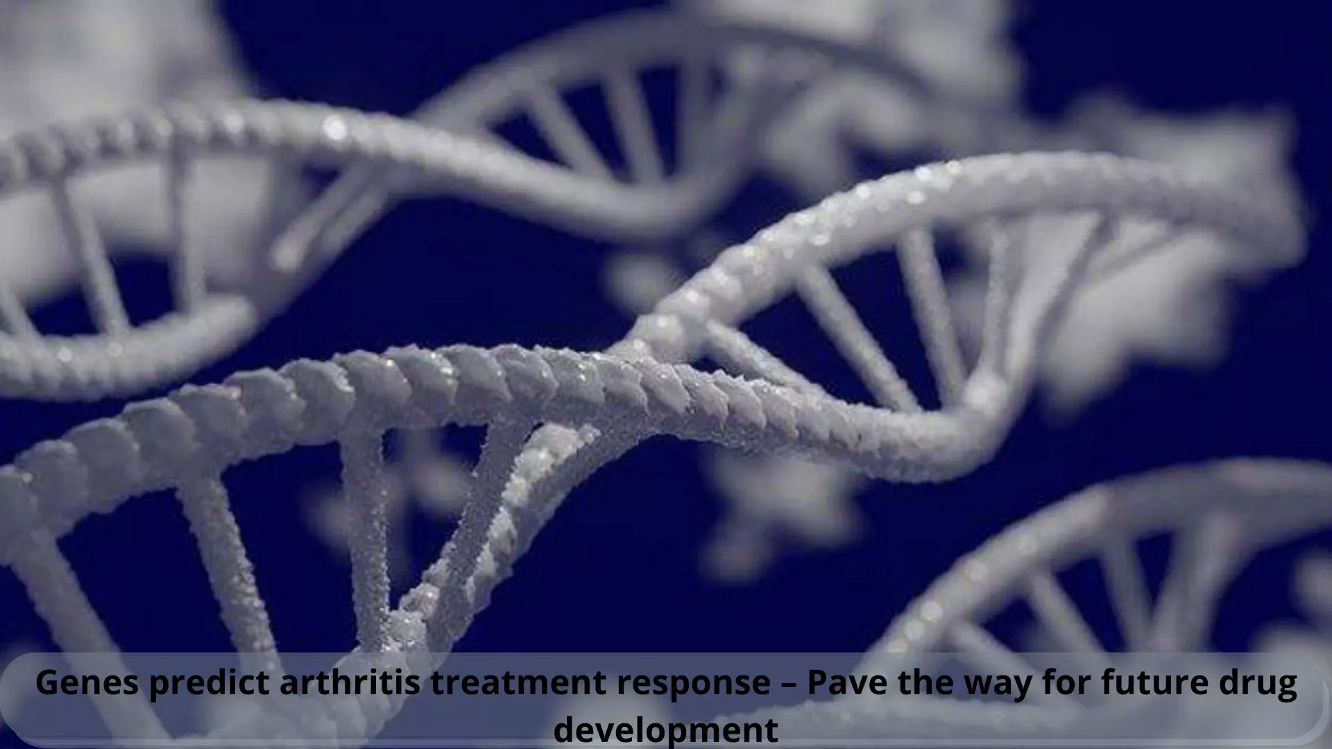 Genes to predict arthritis treatment response – Pave the way for future drug development