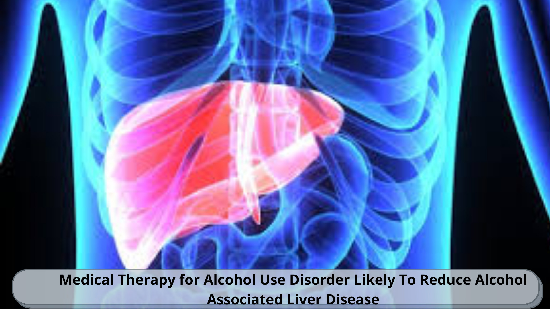 Medical Therapy for Alcohol Use Disorder Likely To Reduce Alcohol ...