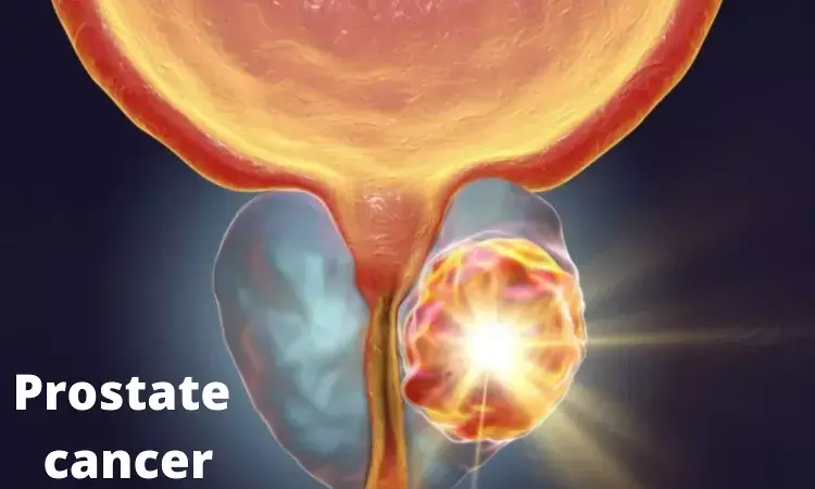 Prostate cancer linked to increased risk of VTE among men