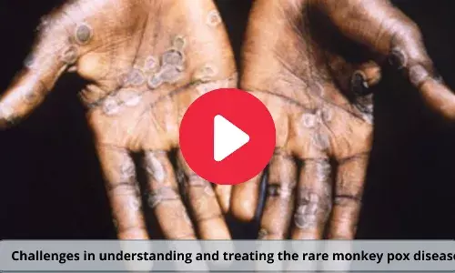 Challenges in understanding and treating the rare monkey pox disease