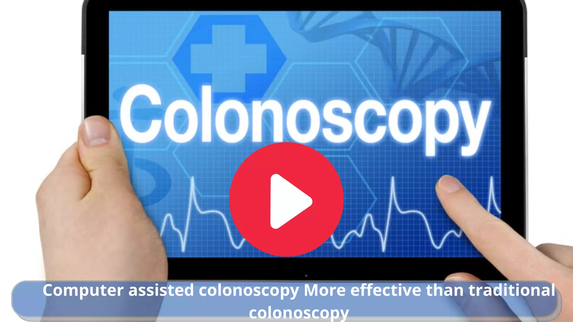 Computer assisted colonoscopy More effective than traditional colonoscopy