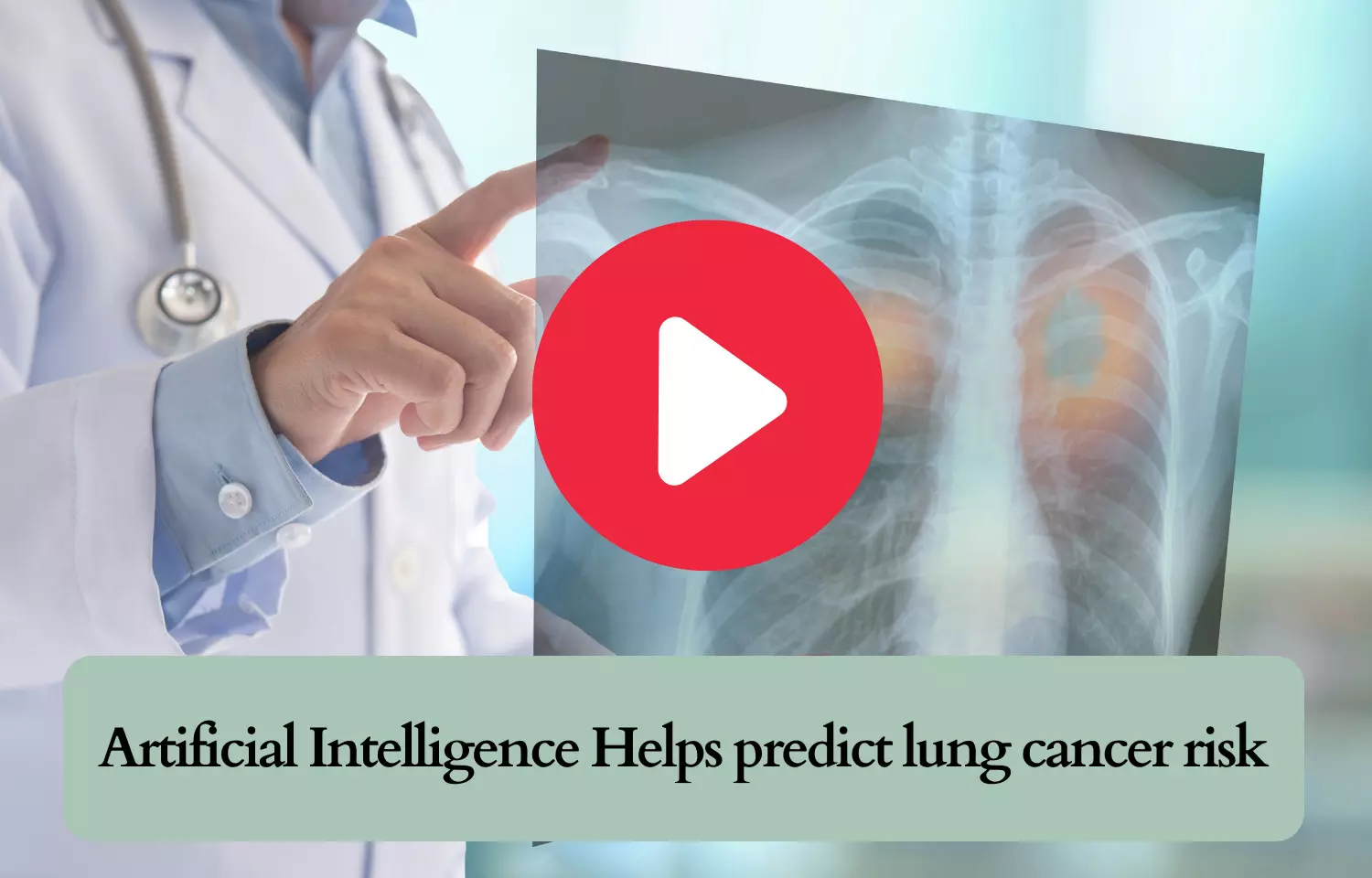 Artificial Intelligence Helps predict lung cancer risk