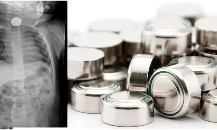 Button battery impaction causes severe pediatric airway injuries: JAMA