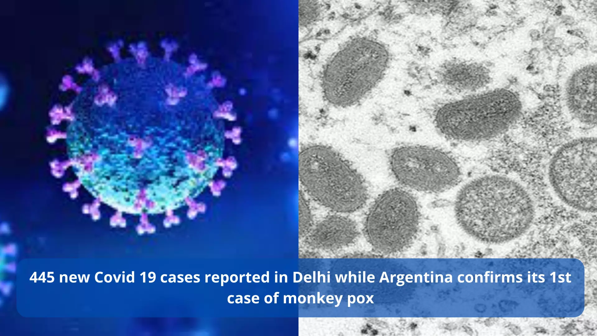 445 new COVID cases reported in Delhi while Argentina confirms its 1st case of monkey pox