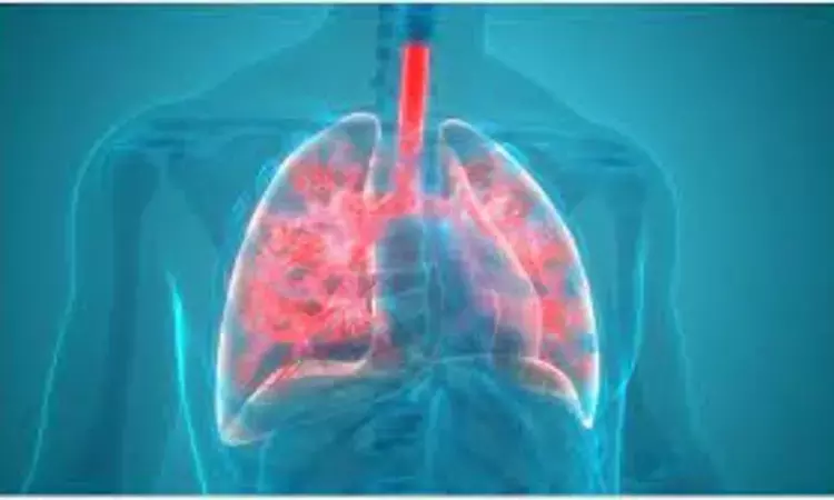 Pneumonia-related AF should not a transient and benign finding: JAMA
