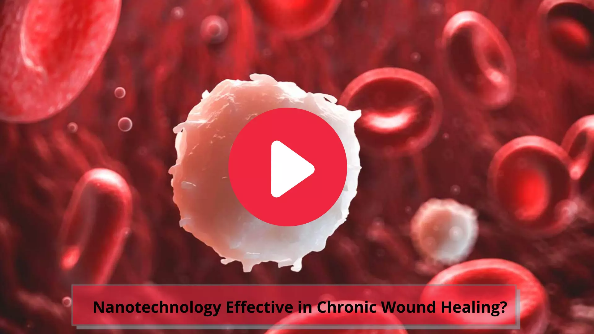 Nanotechnology Effective in Chronic Wound Healing?