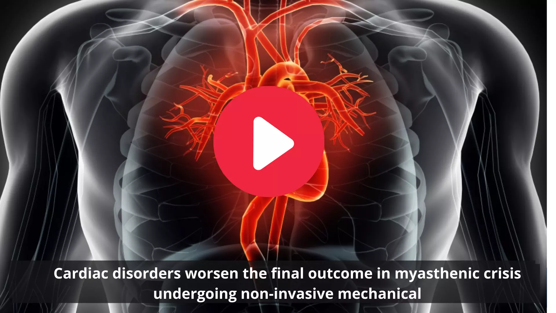 Cardiac disorders worsen the final outcome in myasthenic crisis undergoing non-invasive techniques