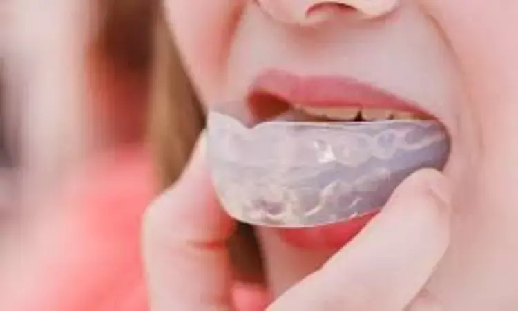 Dentally fitted laminated mouthguards worn on the upper jaw offer best protection during sports