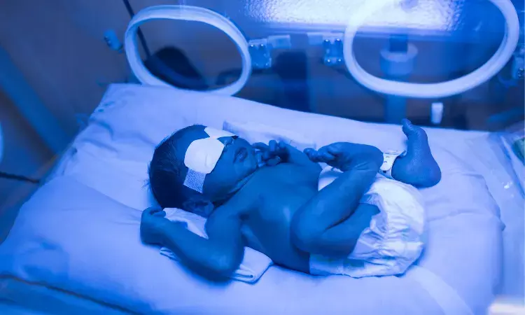 App detecting jaundice in babies a success in first major clinical trial