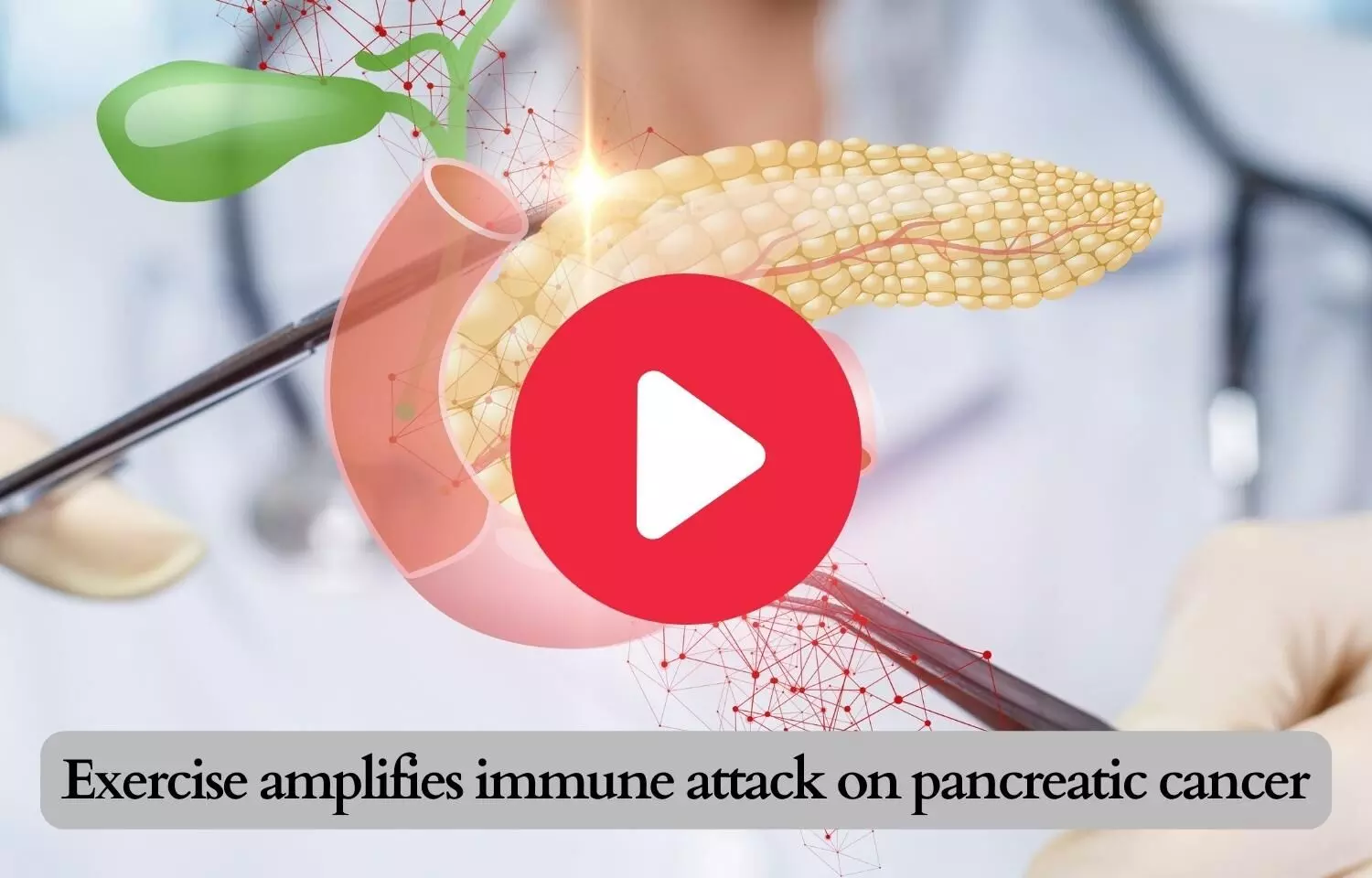 Exercise amplifies immune attack on pancreatic cancer