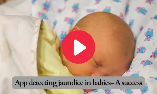 App detecting jaundice in babies- A success