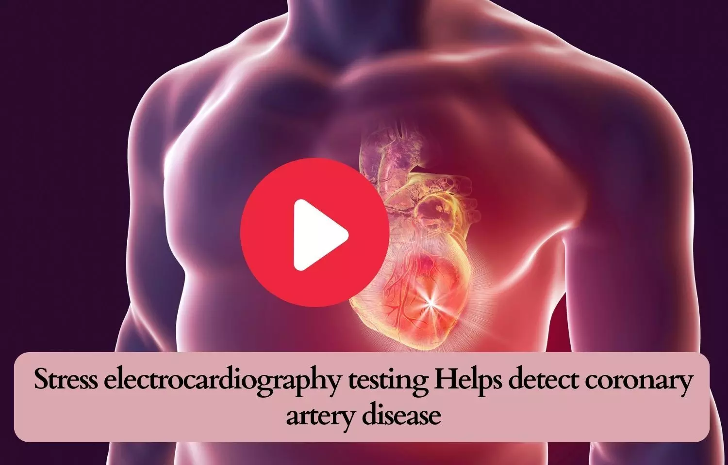 Stress electrocardiography testing Helps detect coronary artery disease