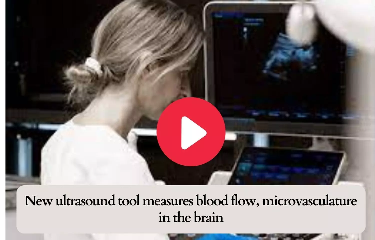 New ultrasound tool measures blood flow, microvasculature in the brain