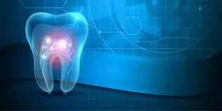 Irradiance using LED-Light curing units in dentistry may damage pulp