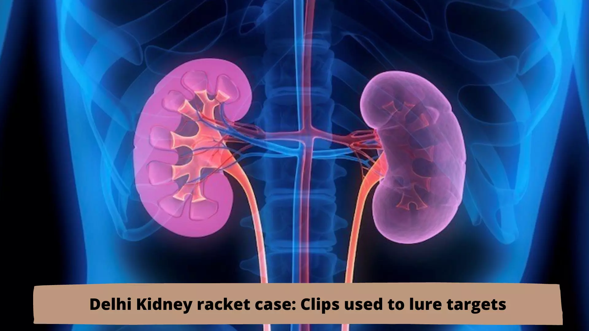 Delhi kidney racket case: Clips used to lure targets