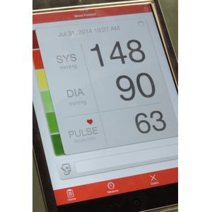 Predictable Norepinephrine Dosing Improves Personalized BP Management During Anaesthesia: Study