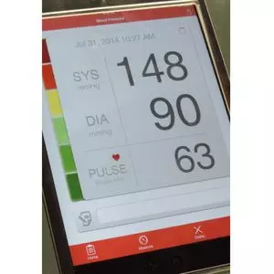 Predictable Norepinephrine Dosing Improves Personalized BP Management During Anaesthesia: Study