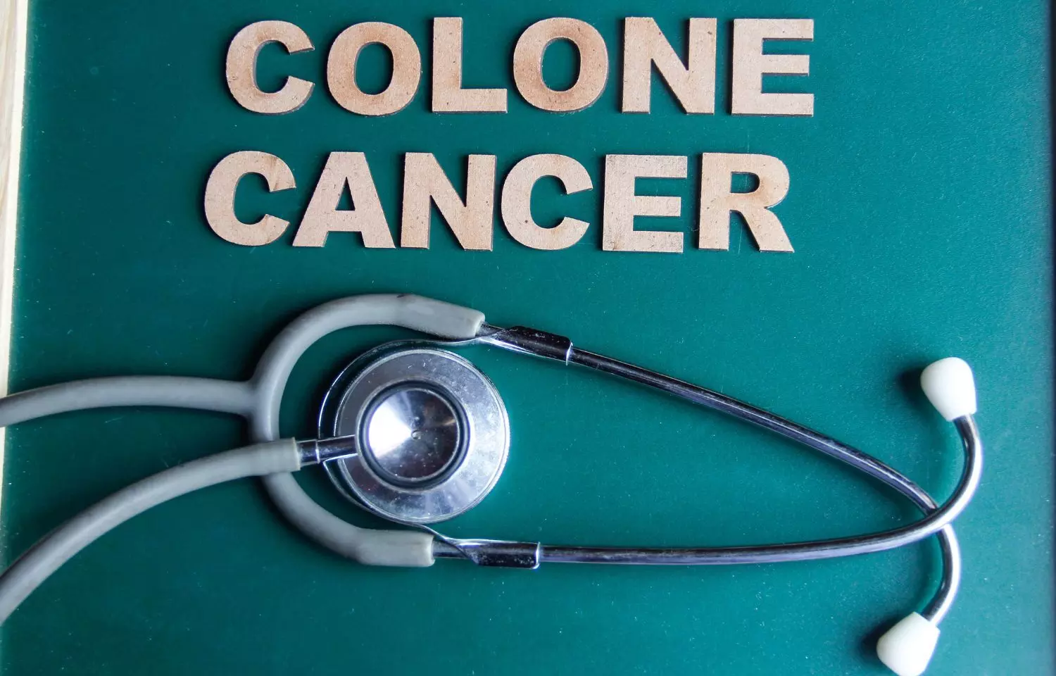 New blood test may identify which colon cancer patients need chemotherapy