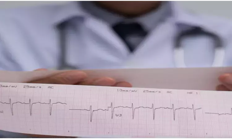 Poor R-wave progression linked to sudden cardiac death: Study