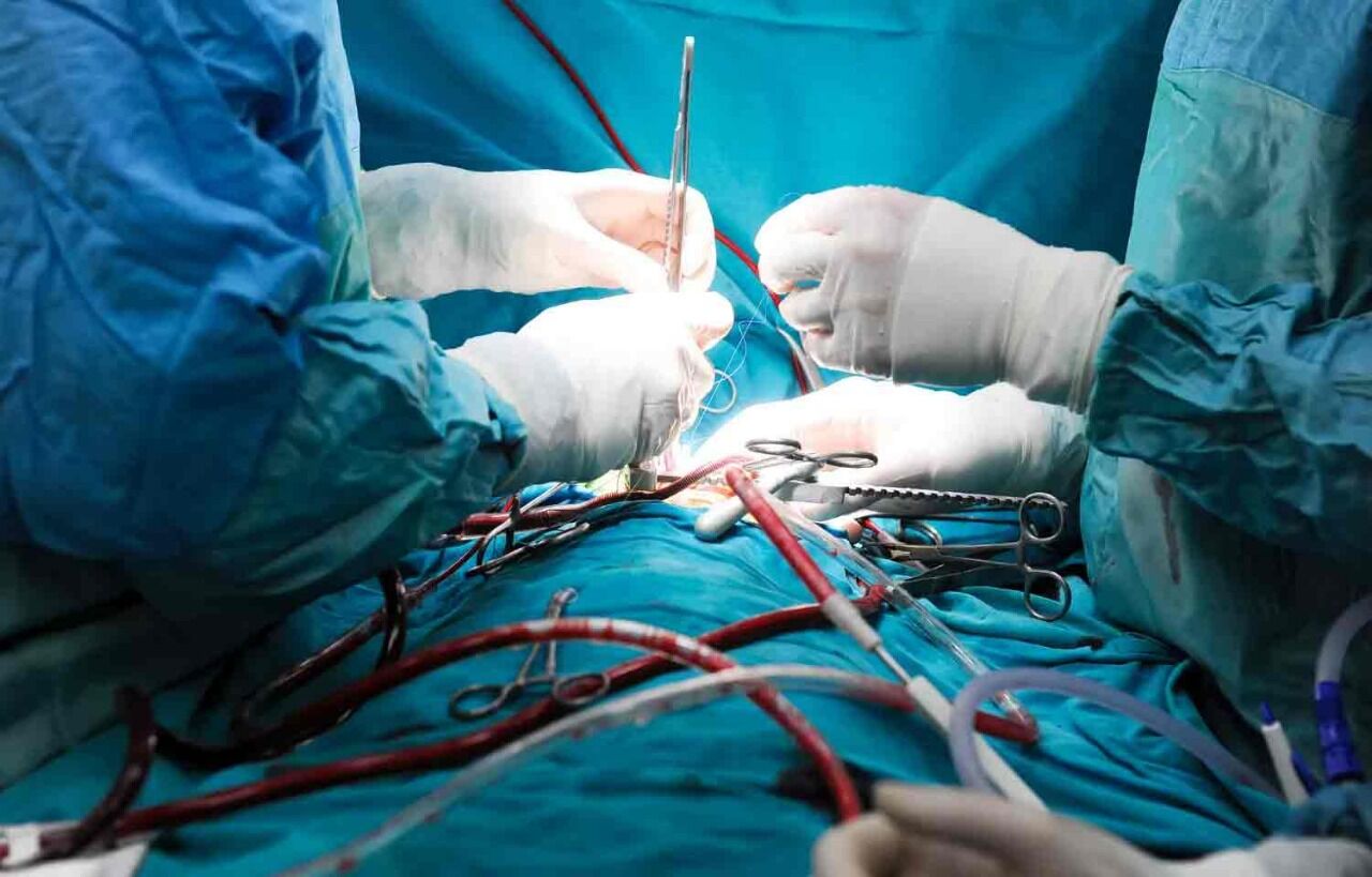 Early Valve Replacement Heart Surgery Beneficial In People With Aortic ...