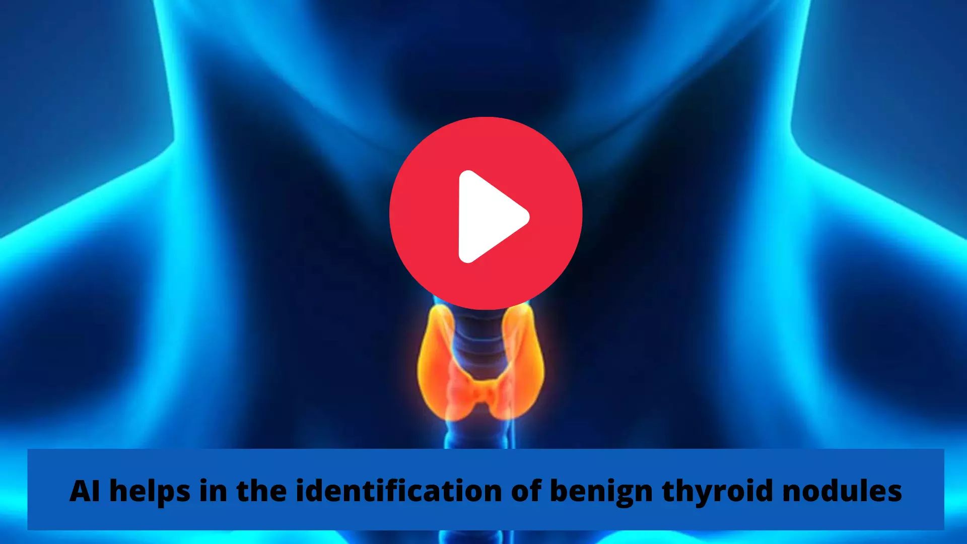 AI helps in the identification of benign thyroid nodules