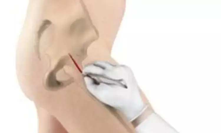 Keyhole Sliding Hip Screw Fixation for Stable Intertrochanteric Hip Fractures: A Novel Technique