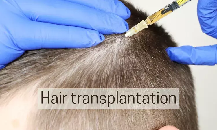 Hair Transplantation facility told to refund after denying surgery to Diabetic patient