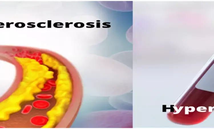 Hyperuricemia may impact role of HDL-C on carotid atherosclerosis, finds study