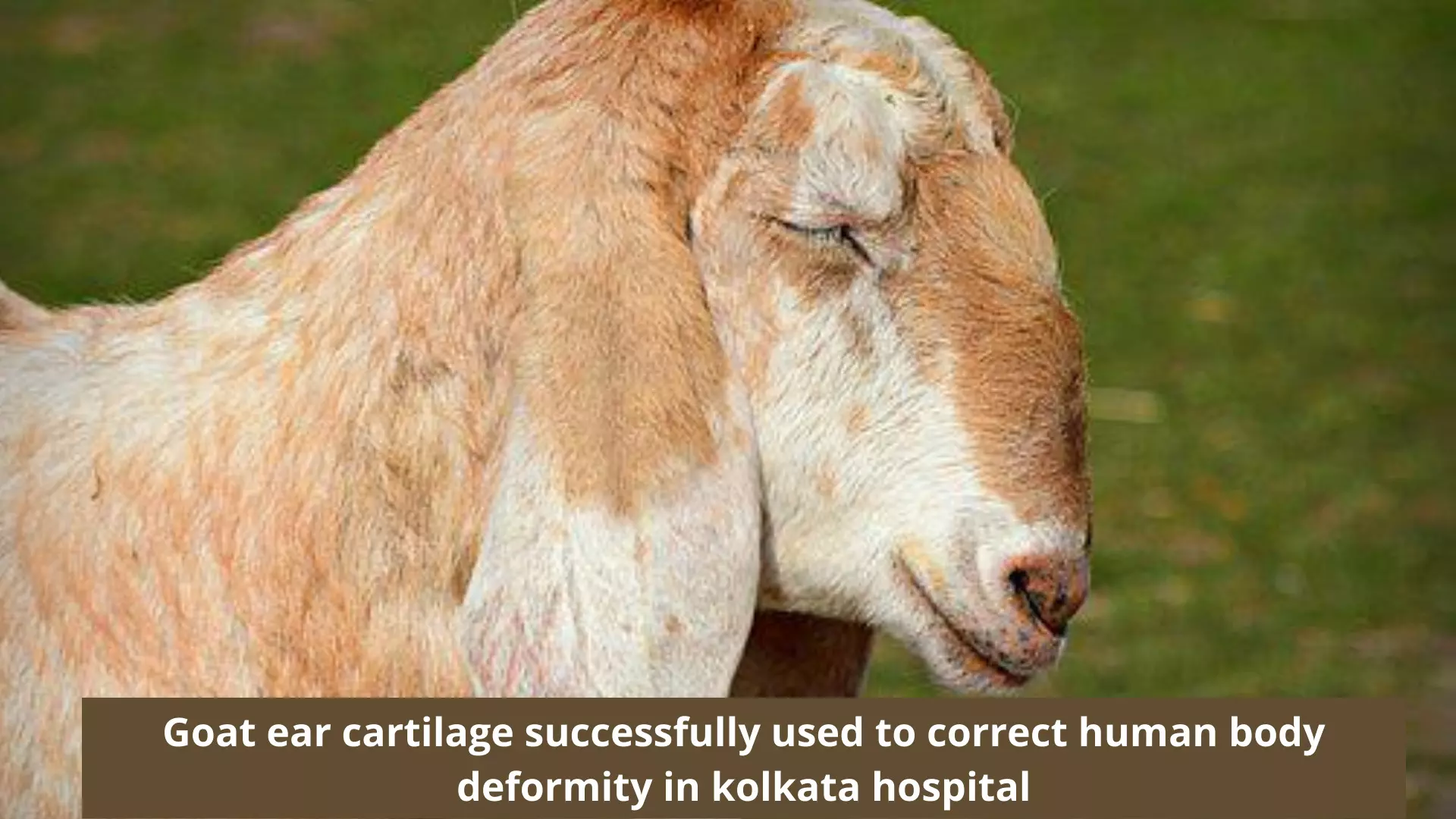 Goat ear cartilage successfully used to correct human body deformity in Kolkata hospital