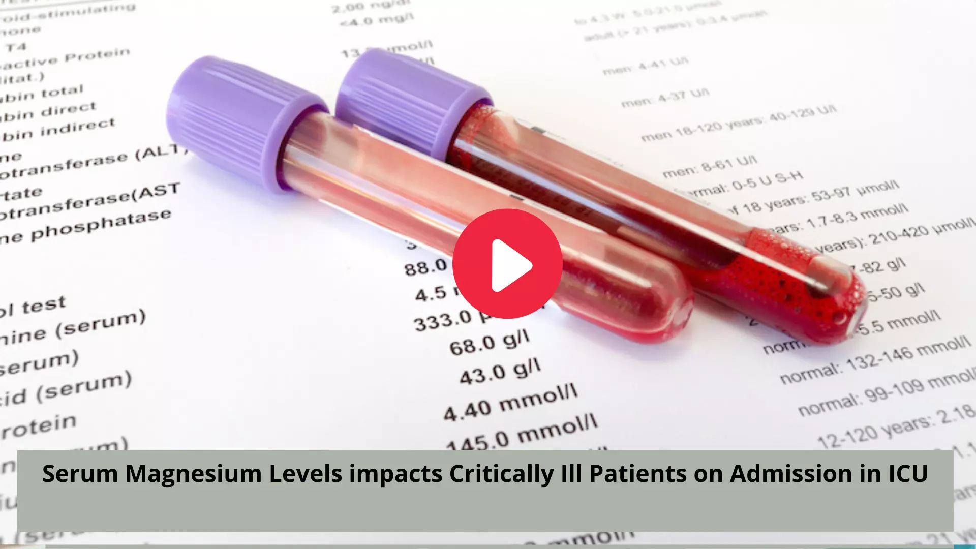 Serum Magnesium Levels impacts Critically Ill Patients on Admission in ICU