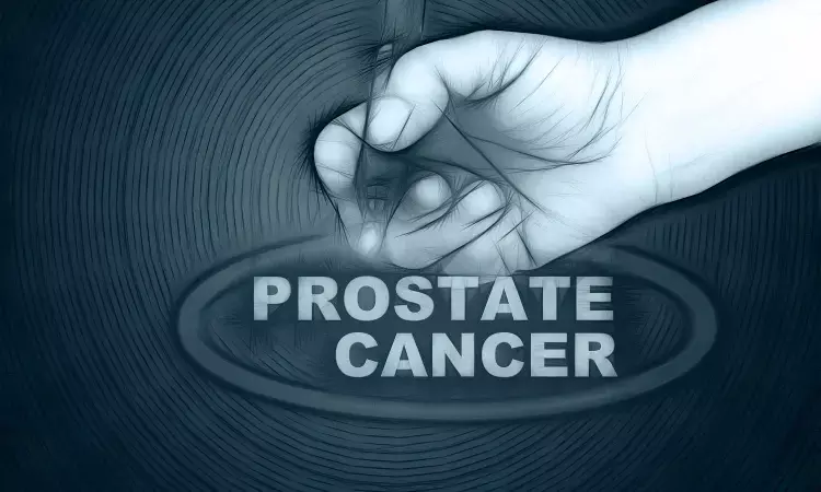 Preoperative MRI may lead to better surgical outcomes for prostate cancer patients