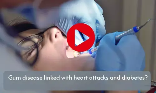 Gum disease linked with heart attacks and diabetes?