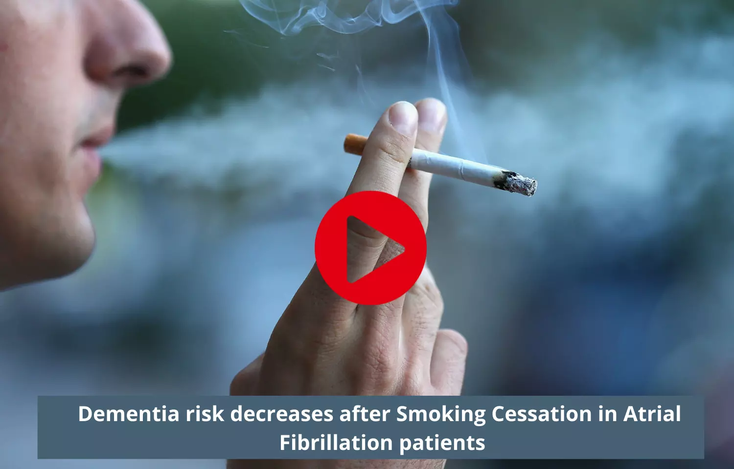 Dementia risk decreases after Smoking Cessation in Atrial Fibrillation patients