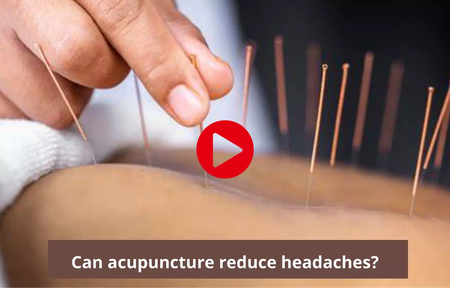 Acupuncture effective in reducing headaches?