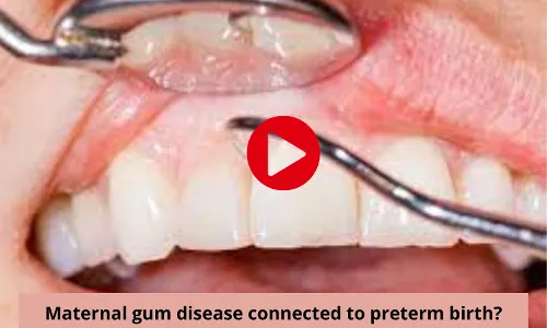Maternal gum disease connected to preterm birth?