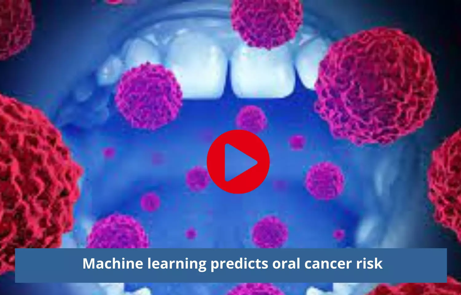 Machine learning  effective in predicting oral cancer risk