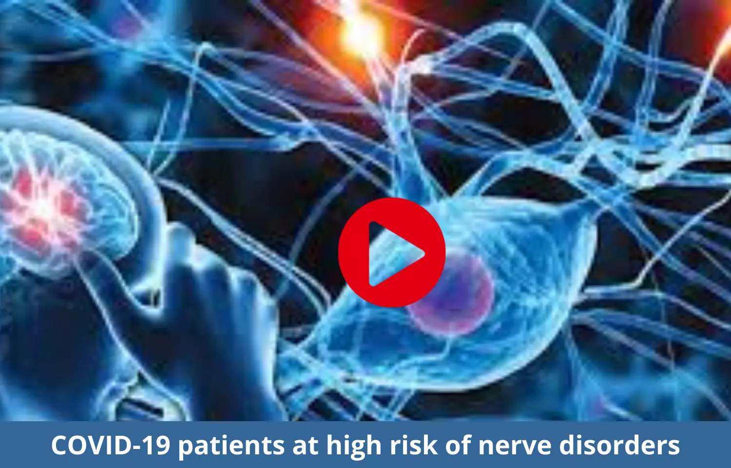 COVID-19 patients at high risk of nerve disorders