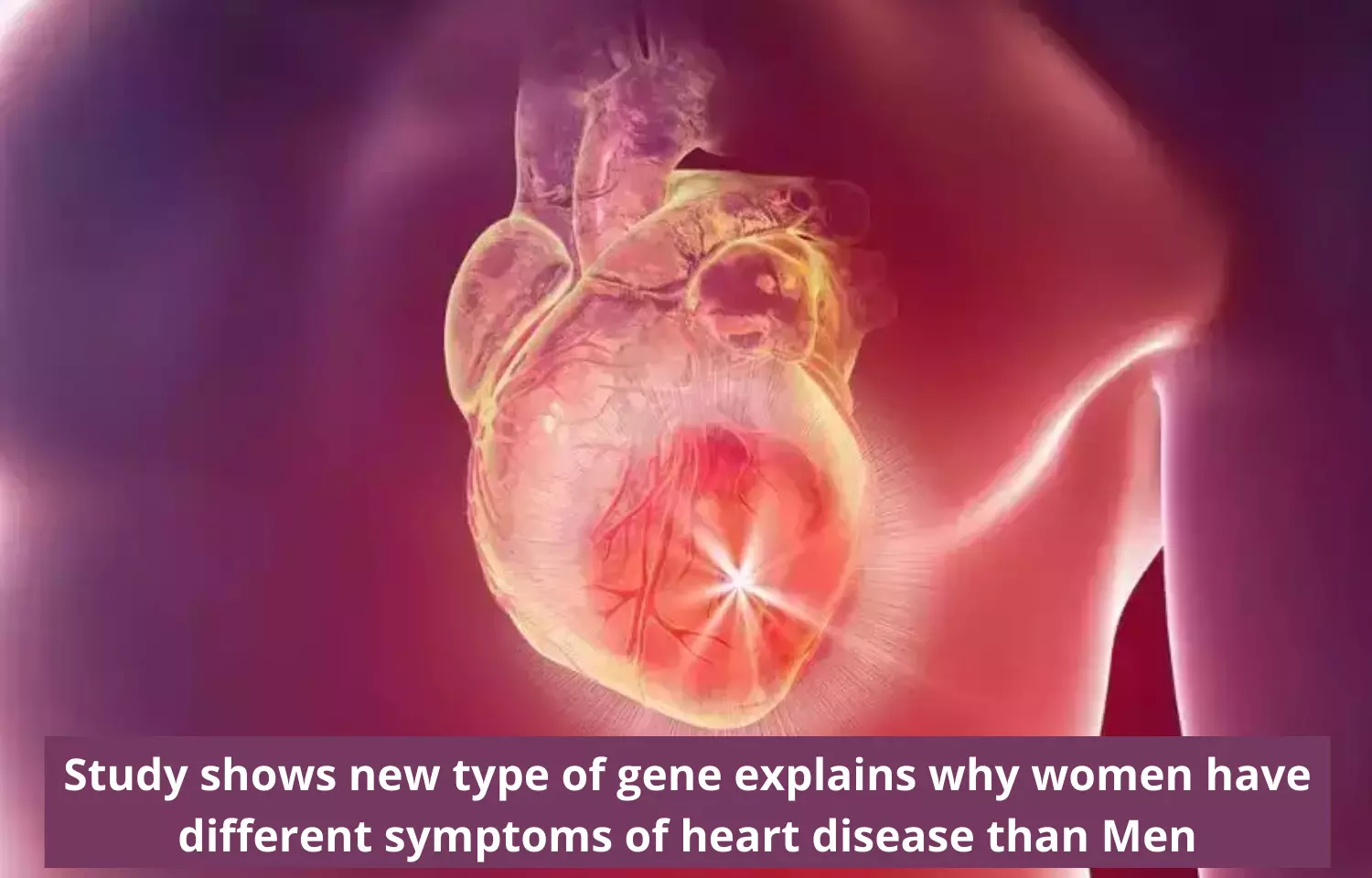 Study shows new type of gene that explains why women have different symptoms of heart disease than men