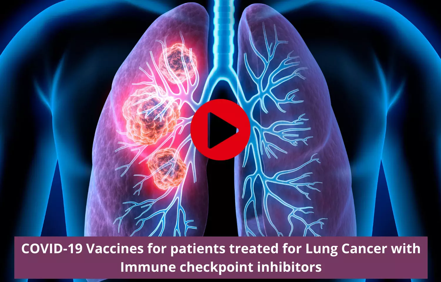 COVID-19 Vaccines for patients treated for Lung Cancer with Immune checkpoint inhibitors