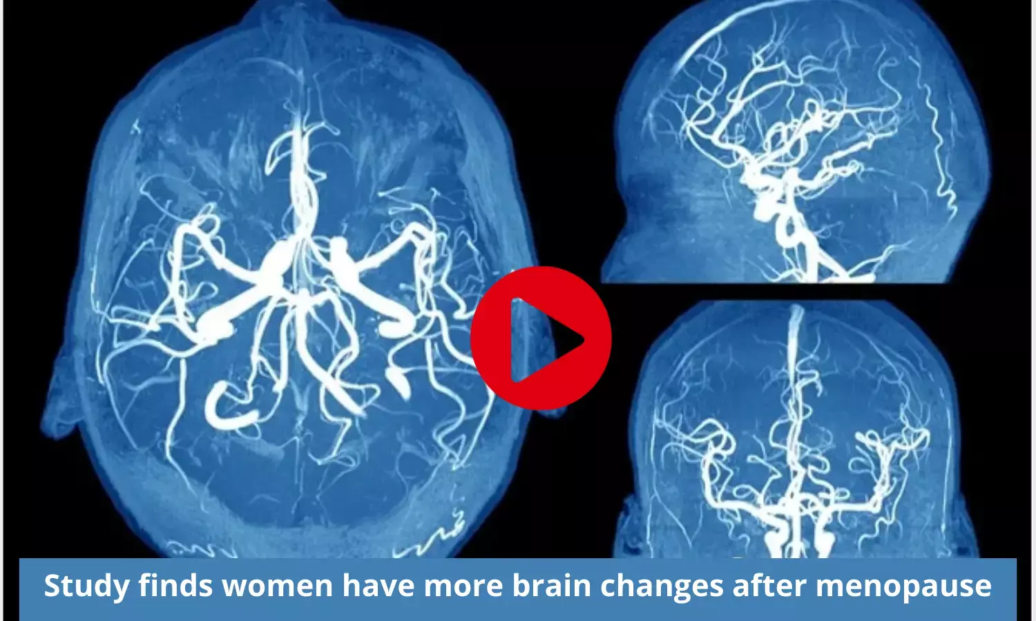 We Need to Know How Menopause Changes Women's Brains - The New
