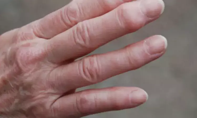 Swelling and not tenderness of joints better predicts synovitis in psoriatic arthritis