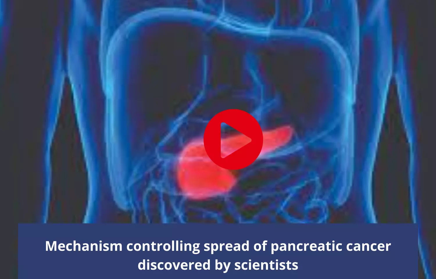 Mechanism controlling spread of pancreatic cancer discovered by scientists