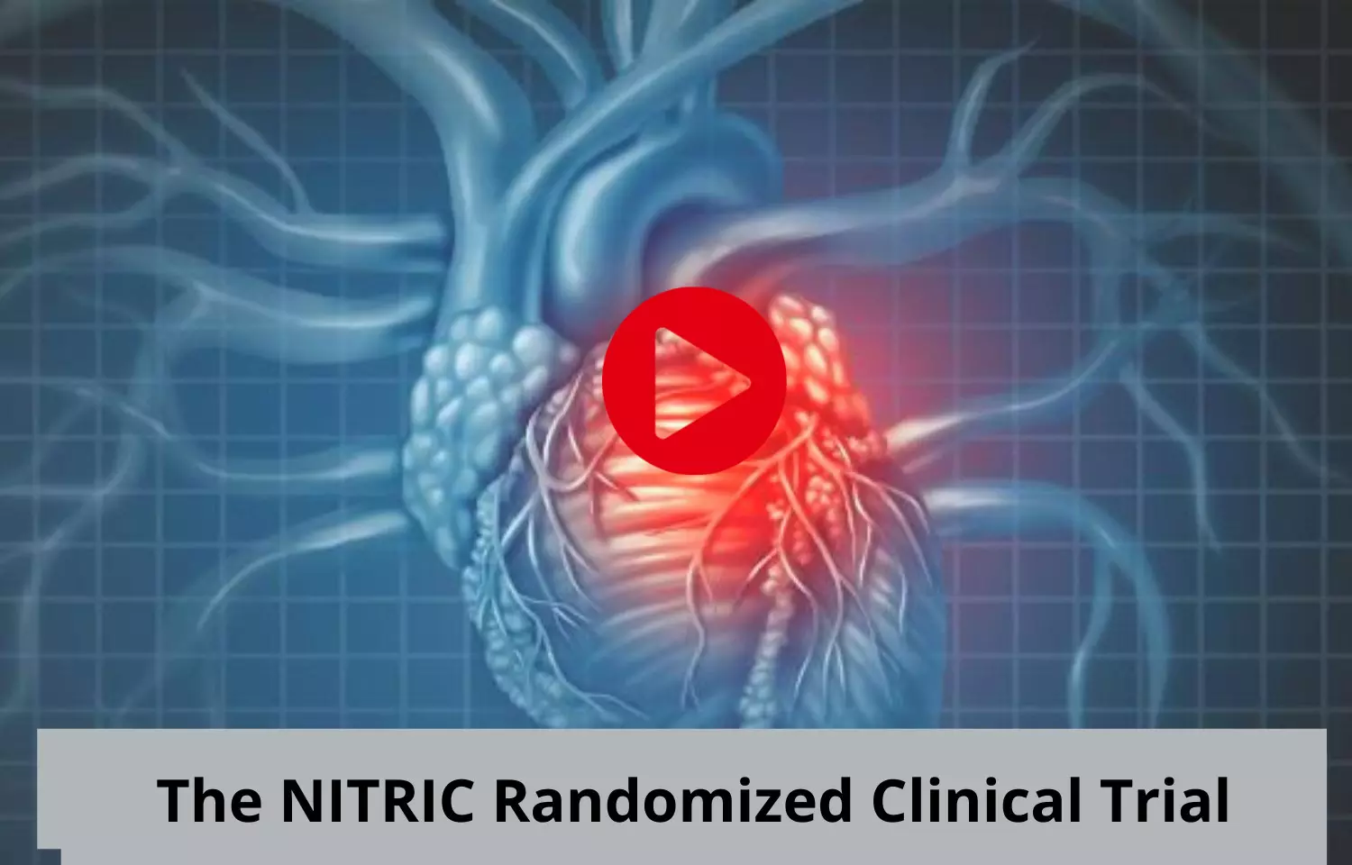 The NITRIC Randomized Clinical Trial